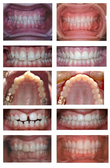 Orthodontics cases